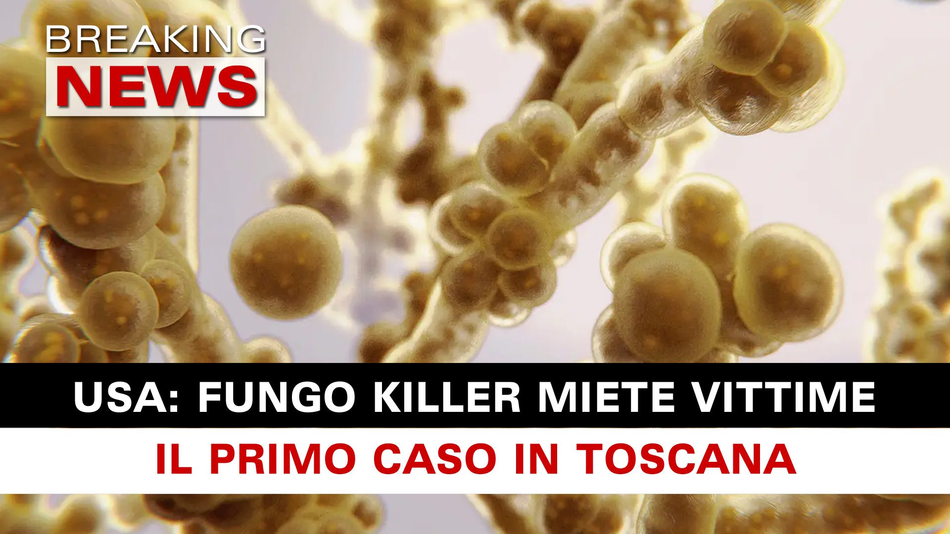 Fungo Killer Allarme Usa La Candida Auris Fa Paura Un Caso In Toscana Breaking News Italia 4724