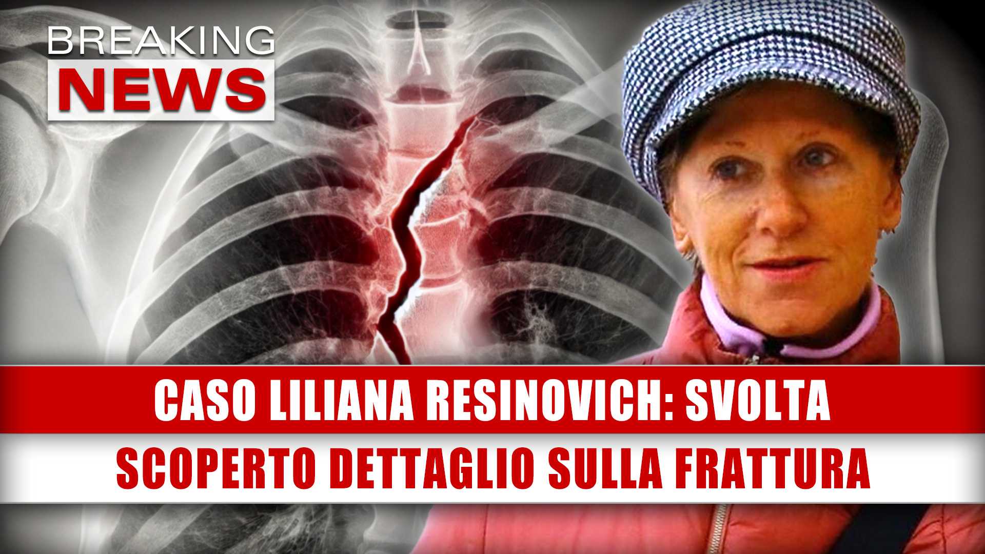 Caso Liliana Resinovich, Svolta: Scoperto Dettaglio Sulla Frattura!